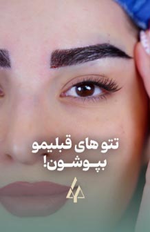 کاور تتوهای قدیمی با میکروکاشت ابرو