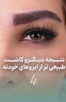 نتیجه نهایی میکروکاشت ابرو