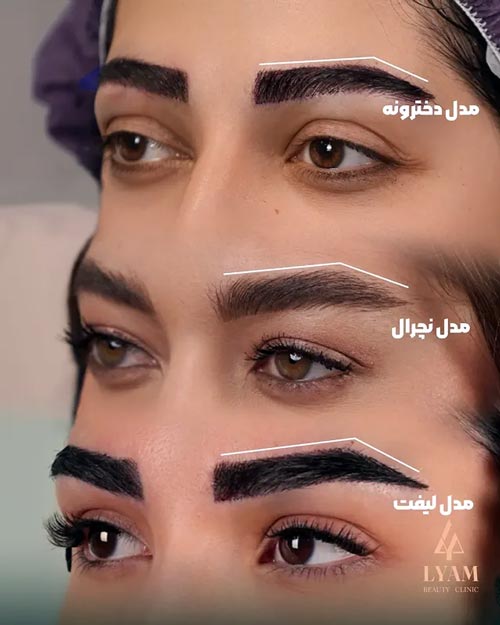 مدل کاشت ابروی طبیعی