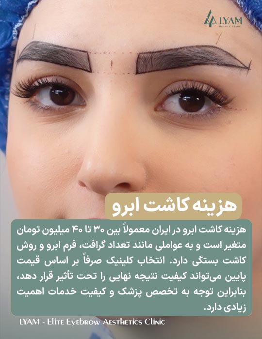 هزینه کاشت ابرو