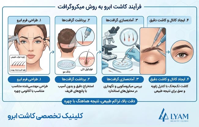 مراحل کاشت ابرو به روش میکروگرافت