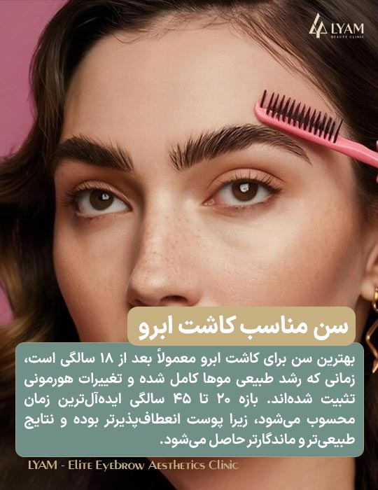 سن مناسب کاشت ابرو