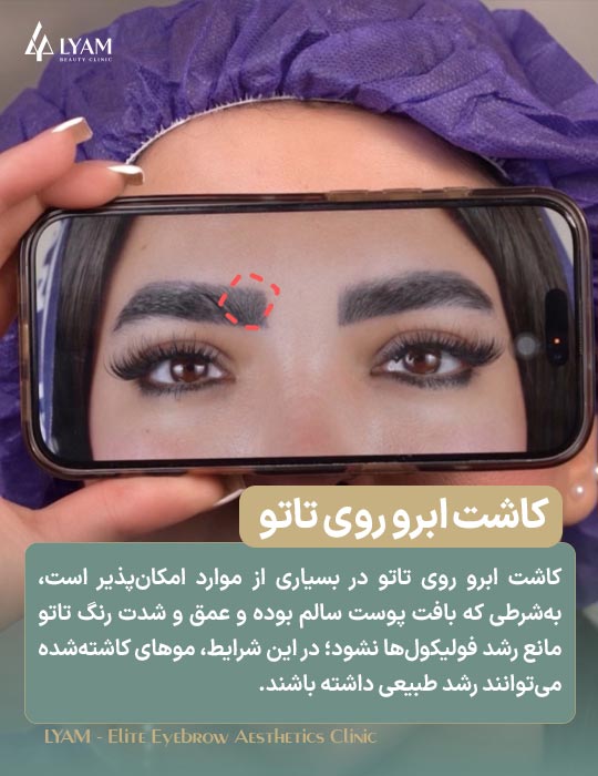 کاشت ابرو روی تاتو