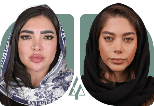 زیبایی ابروها، با دقت و ظرافت لیام