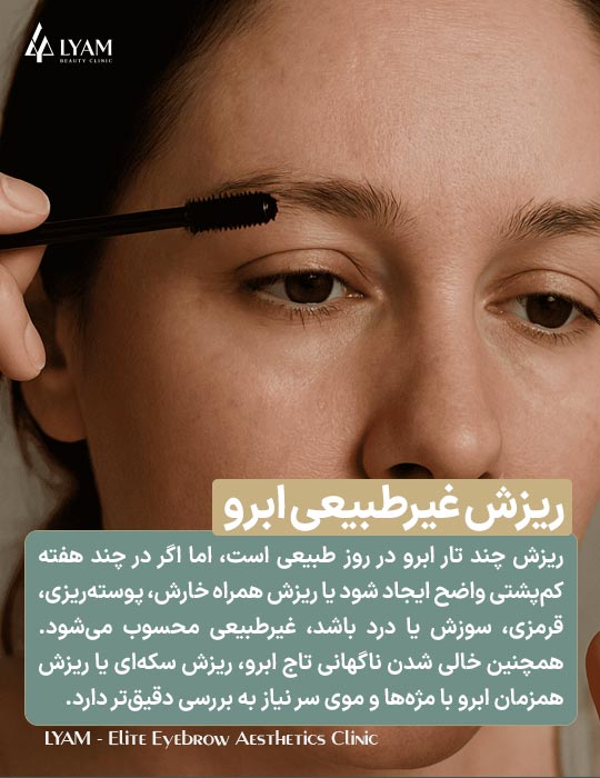 ریزش غیر طبیعی ابرو