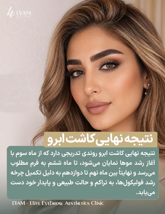 نتیجه نهایی کاشت ابرو