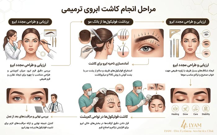 مراحل کاشت ابروی ترمیمی
