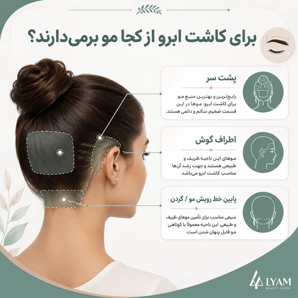 محل برداشت گرافت ها در کاشت ابرو