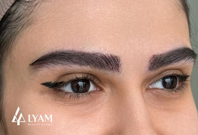 بانک مو در کاشت ابرو چیست؟ موها را از کجا برمی‌دارند؟