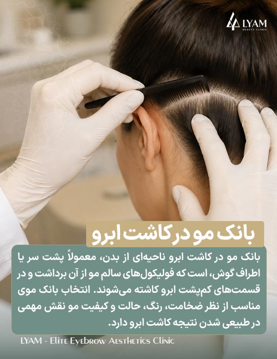 بانک مو در کاشت ابرو