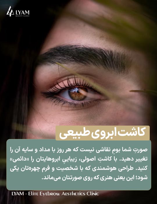 کاشت ابروی طبیعی