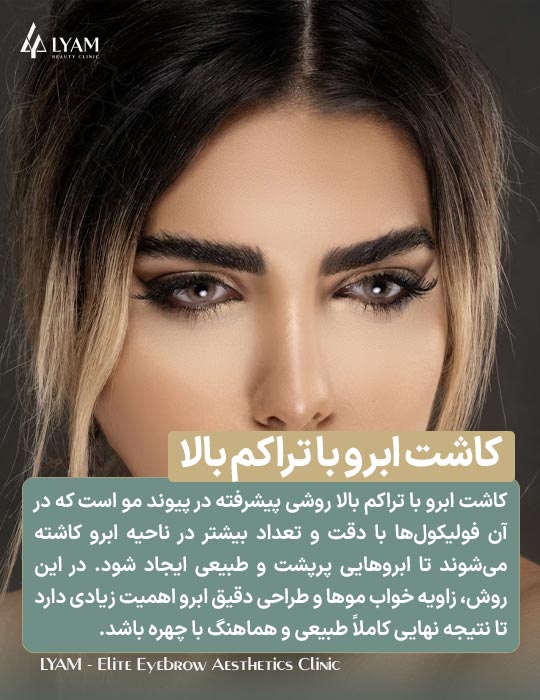 کاشت ابروی پر تراکم
