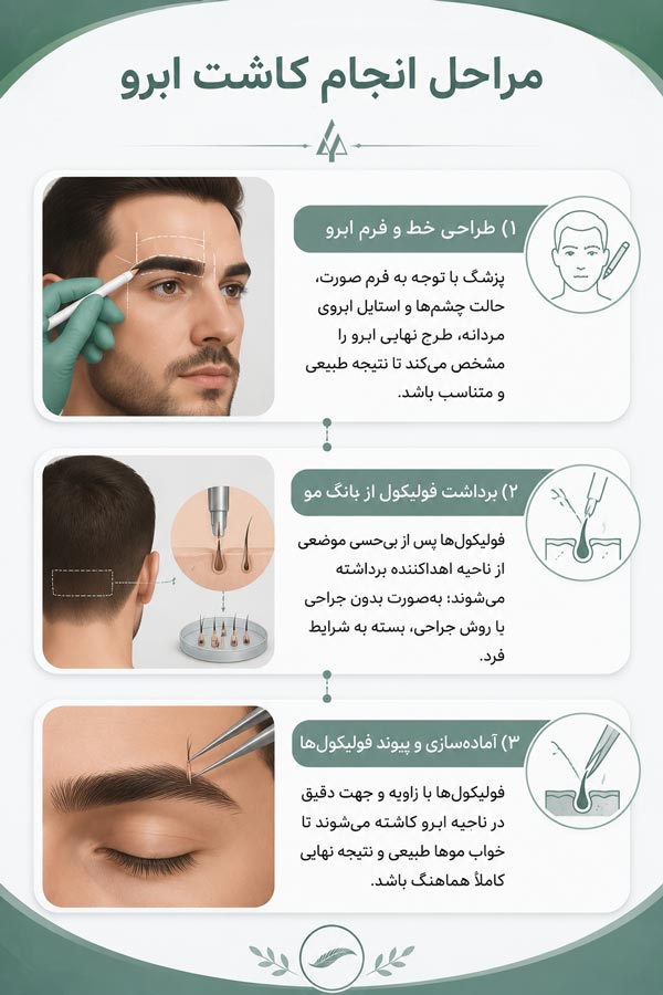 مراحل کاشت ابروی مردانه
